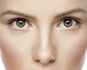 mulher pós rinoplastia